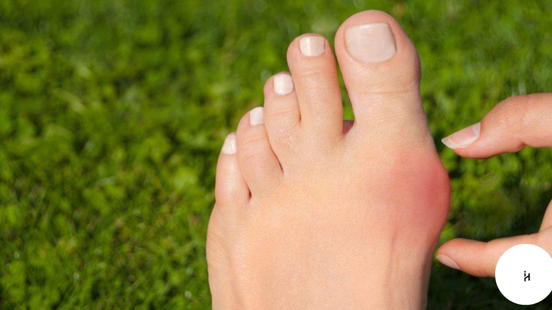 Turf Toe